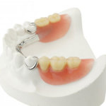 Partial Dentures Thumb